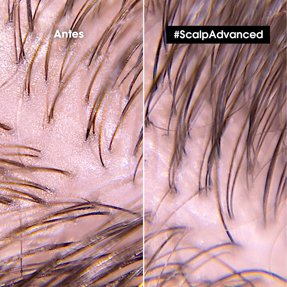 Arcilla Purificante 2 en 1 Cuero Cabelludo Graso Scalp Advanced L’Oreal Serie Expert 250ml - Imagen 4