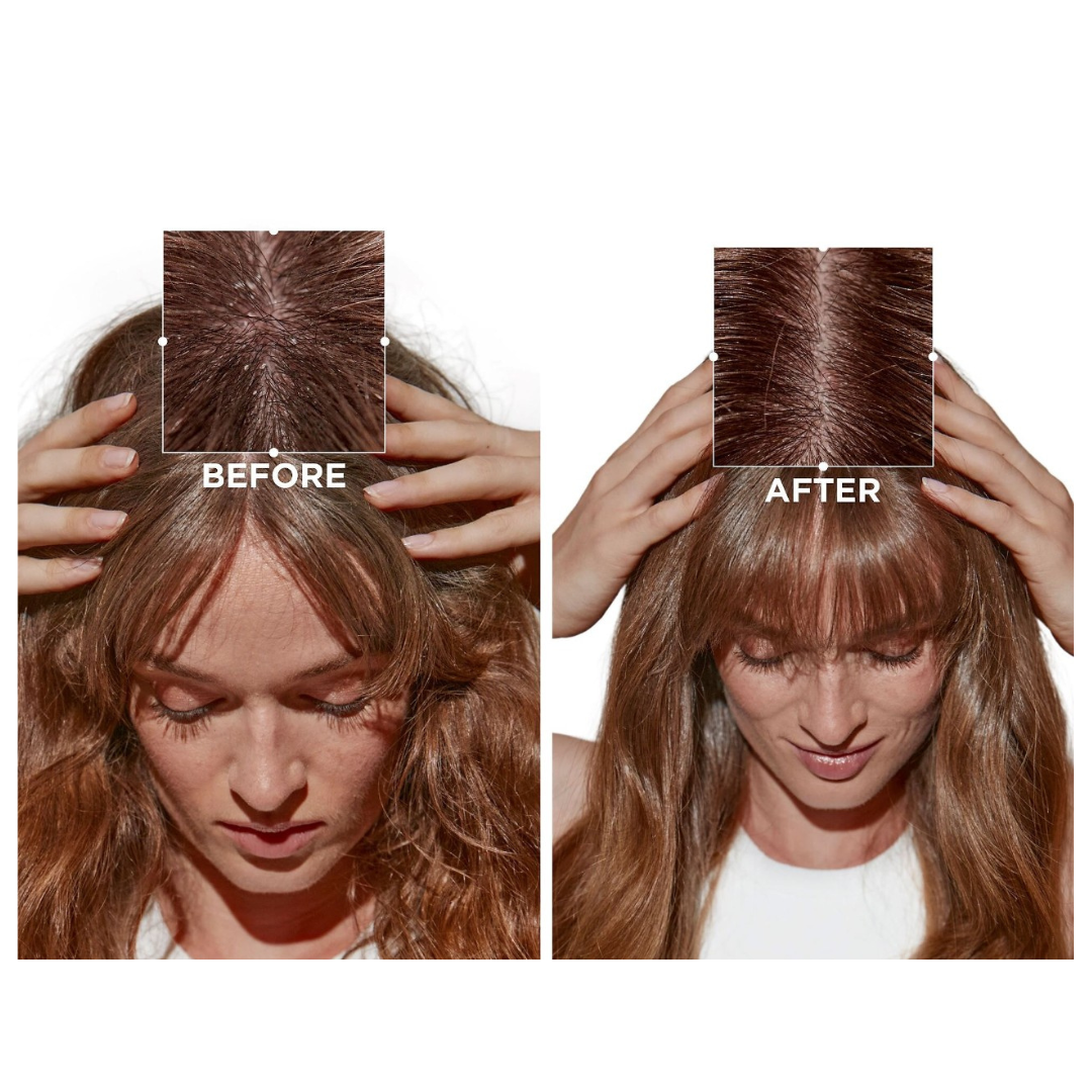 Shampoo Anti-Caspa para Cabello Seco Symbiose Kerastase 250ml - Imagen 4
