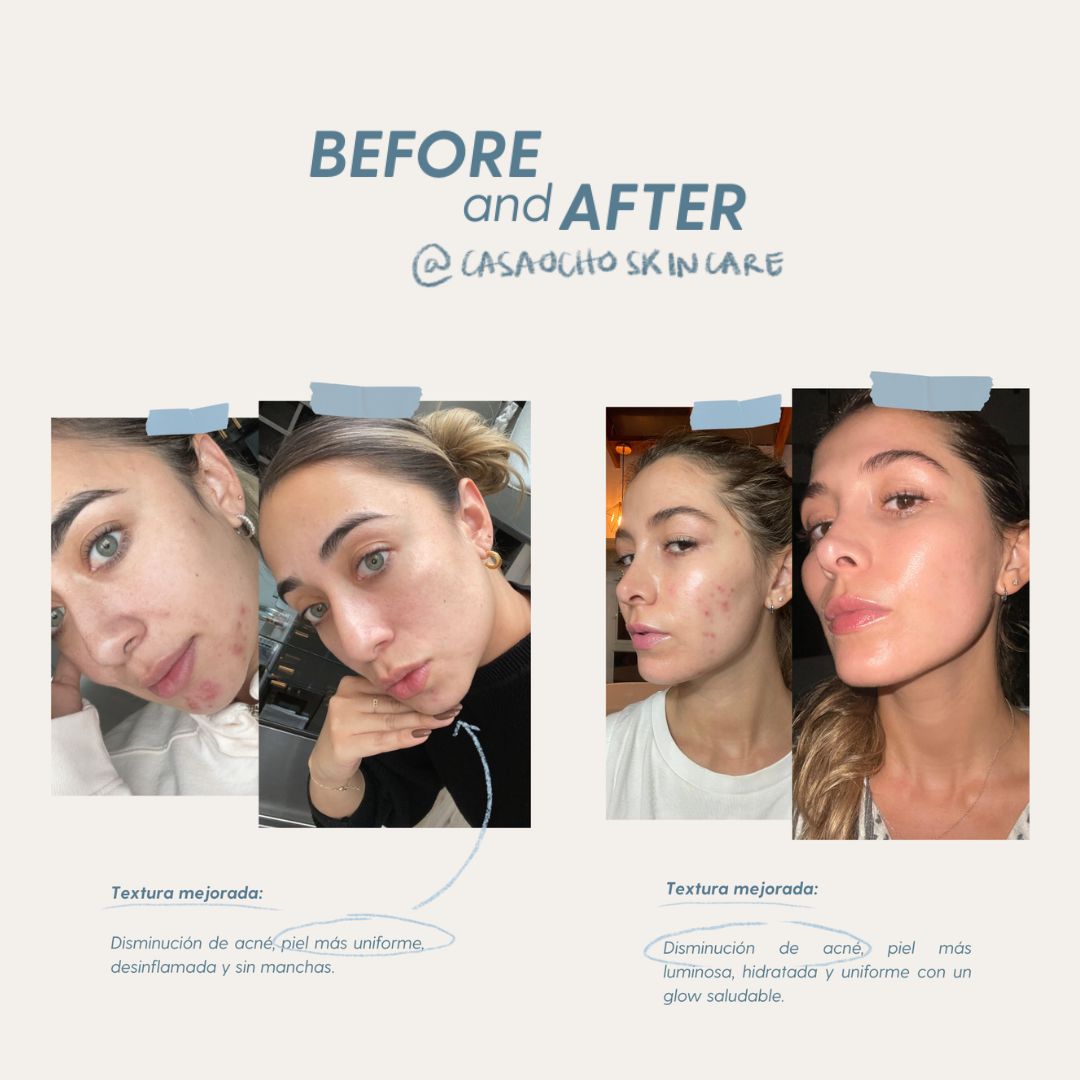Serum Nutritivo Skin Cocktail Casa Ocho Skincare 30ml (Paso 2) - Imagen 5