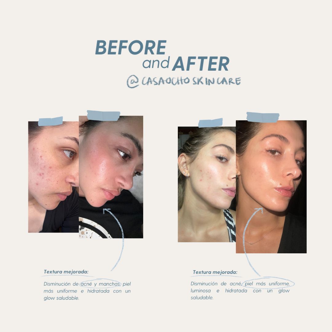 Serum Nutritivo Skin Cocktail Casa Ocho Skincare 30ml (Paso 2) - Imagen 4