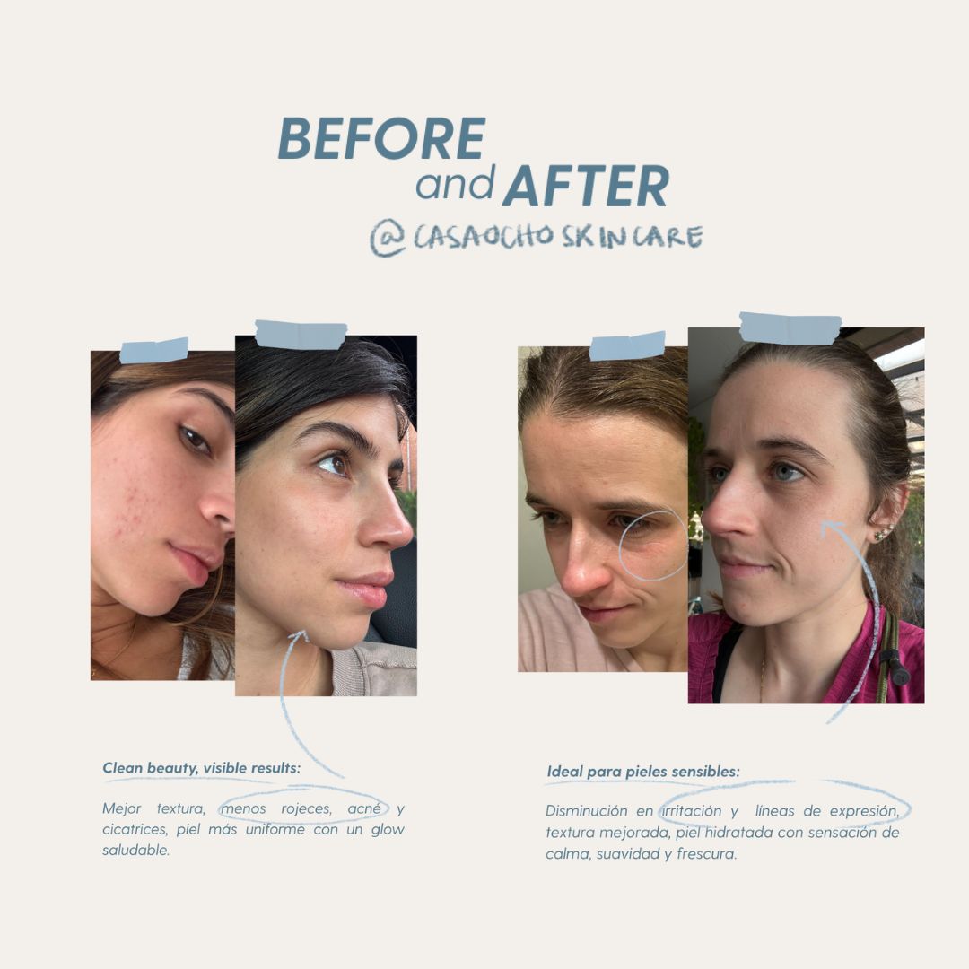Serum Nutritivo Skin Cocktail Casa Ocho Skincare 30ml (Paso 2) - Imagen 6